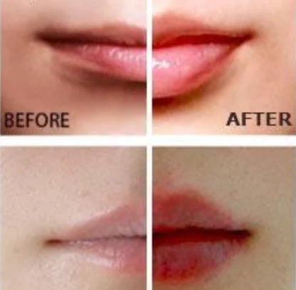 Miracle Lip Plumper